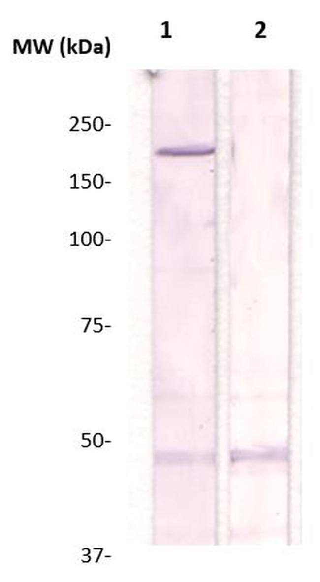 Phospho-Rho Kinase/ROCKII (Thr249) Antibody in Western Blot (WB)