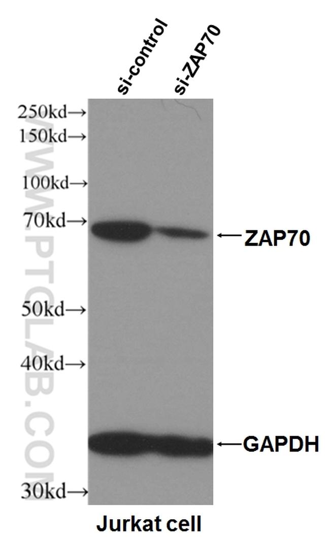 ZAP70 Antibody in Western Blot (WB)