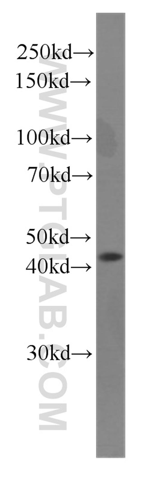 p504S/AMACR Antibody in Western Blot (WB)