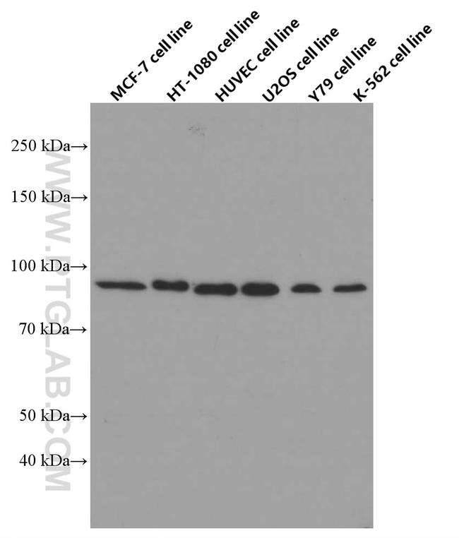 FGFR1 Antibody in Western Blot (WB)
