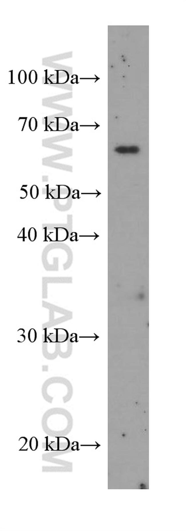 Bestrophin-1 Antibody in Western Blot (WB)
