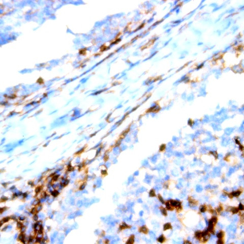 CD195/CCR5 Antibody in Immunohistochemistry (Paraffin) (IHC (P))