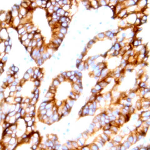 Claudin 5 Antibody in Immunohistochemistry (Paraffin) (IHC (P))