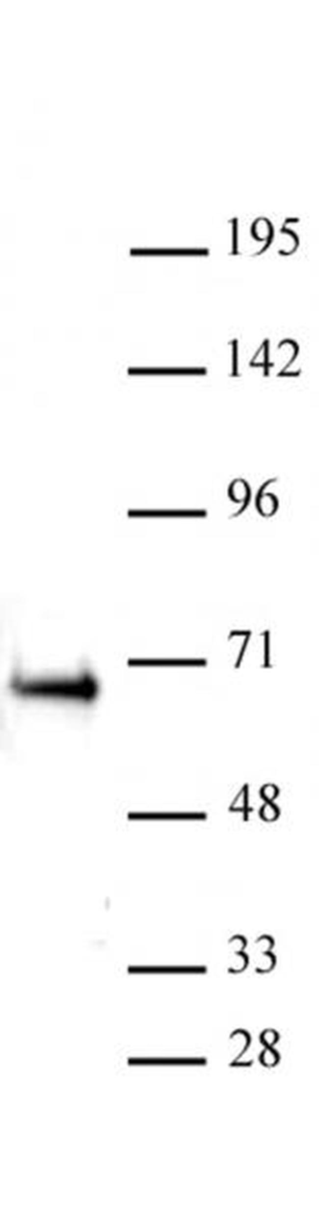ETO / RUNX1T1 Antibody in Western Blot (WB)