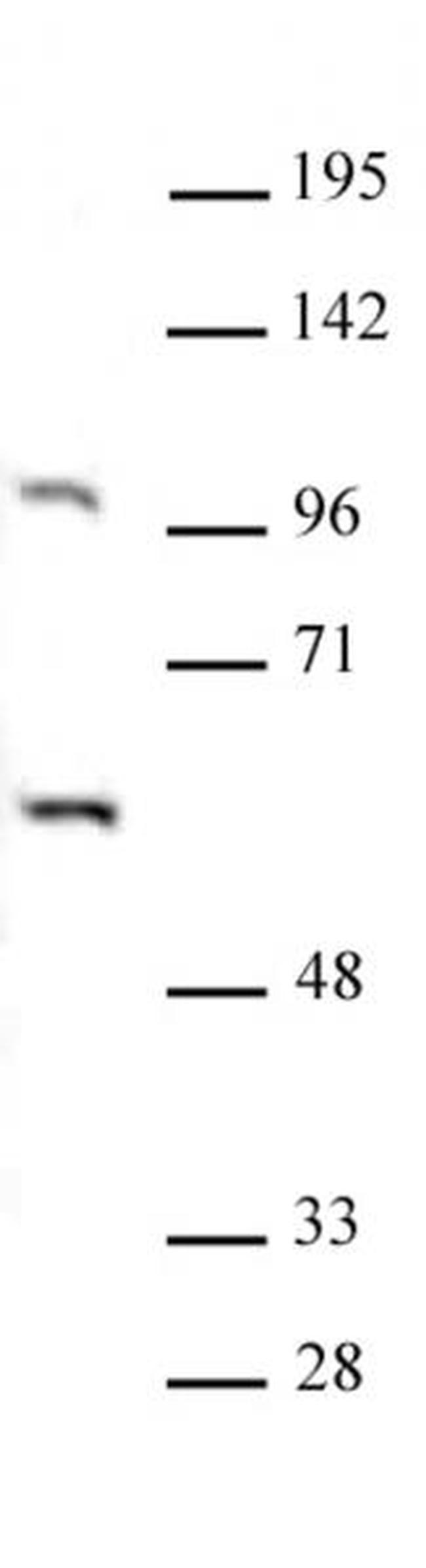PAF1 Antibody in Western Blot (WB)