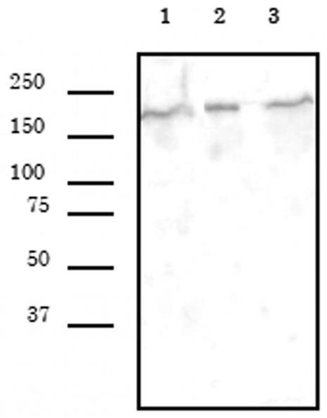 SMARCA4 Antibody in Western Blot (WB)