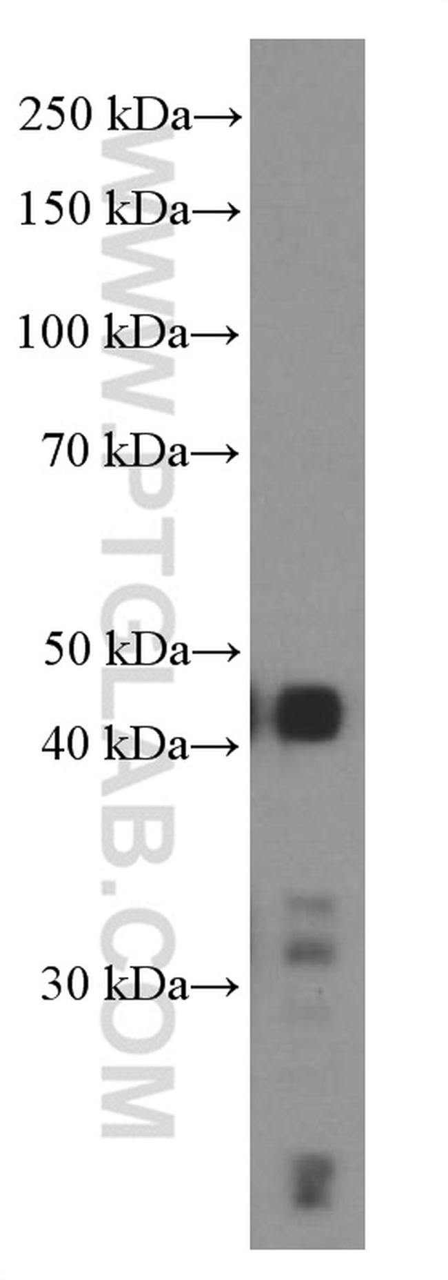 TTF-1 Antibody in Western Blot (WB)