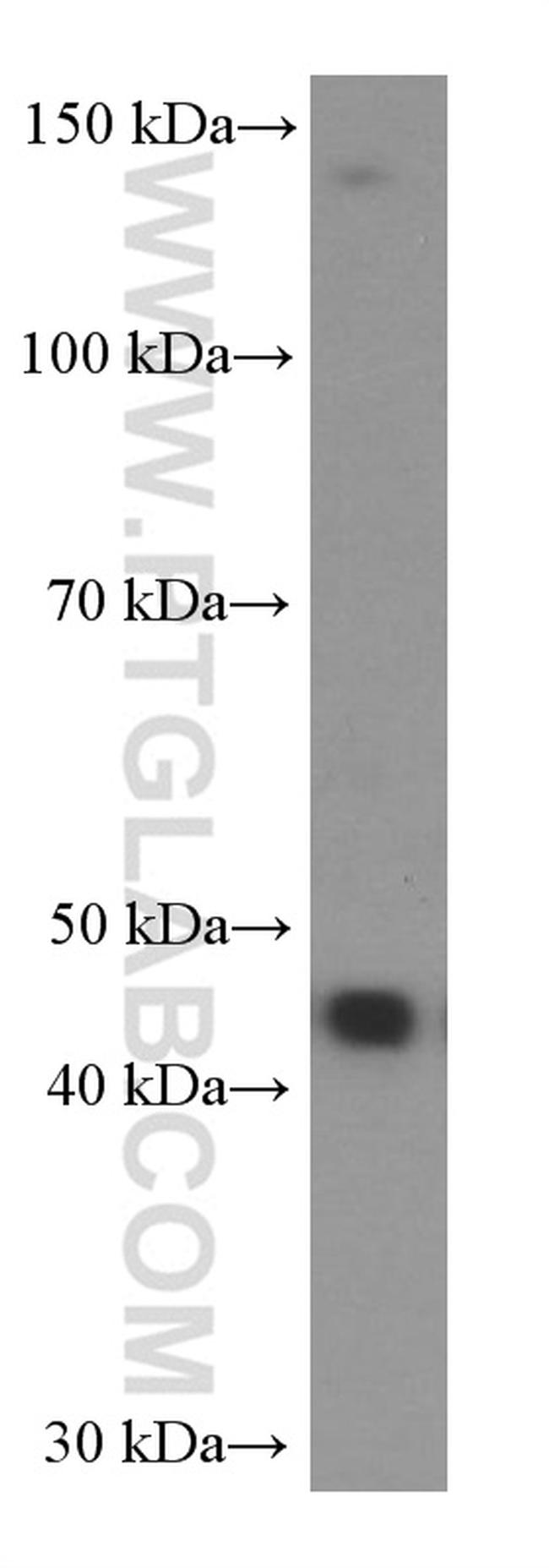 NOB1 Antibody in Western Blot (WB)