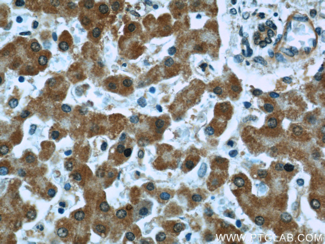 EXOSC2 Antibody in Immunohistochemistry (Paraffin) (IHC (P))
