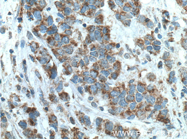 ECHS1 Antibody in Immunohistochemistry (Paraffin) (IHC (P))