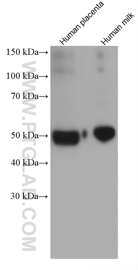Alpha-1-Antitrypsin Antibody in Western Blot (WB)