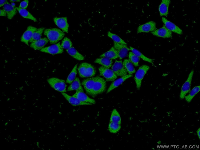 Fibrinogen gamma chain Antibody in Immunocytochemistry (ICC/IF)