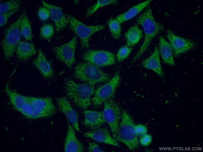 APOD Antibody in Immunocytochemistry (ICC/IF)