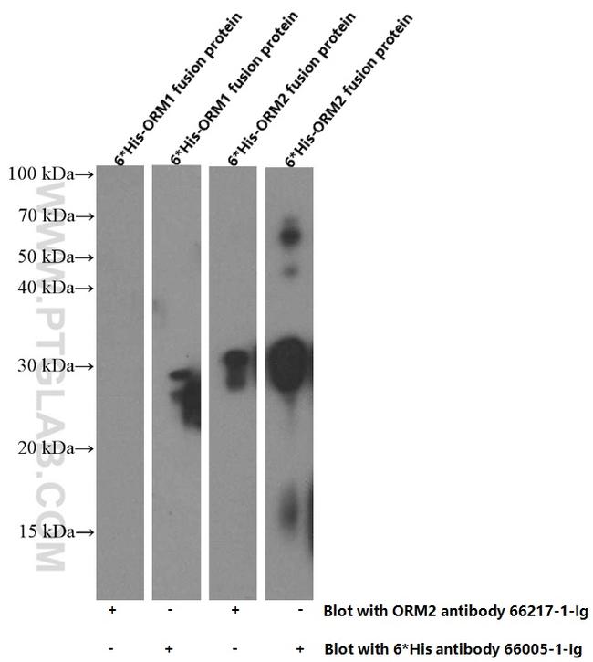 ORM2 Antibody in Western Blot (WB)