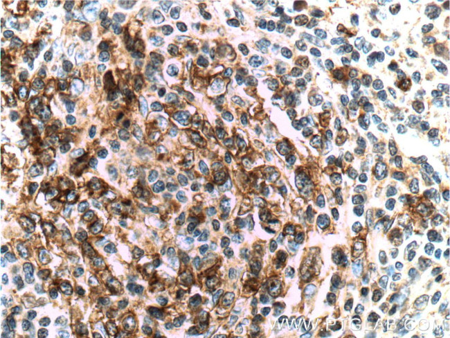 PD-1/CD279 Antibody in Immunohistochemistry (Paraffin) (IHC (P))