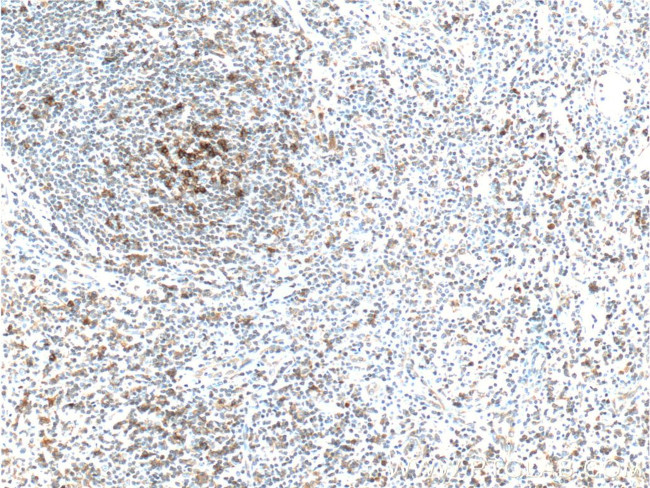 PD-1/CD279 Antibody in Immunohistochemistry (Paraffin) (IHC (P))