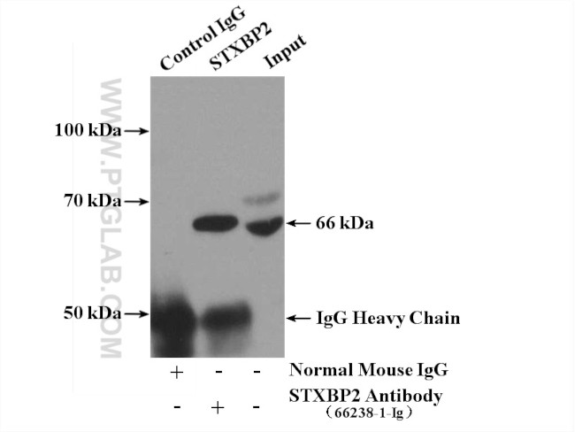STXBP2 Antibody in Immunoprecipitation (IP)