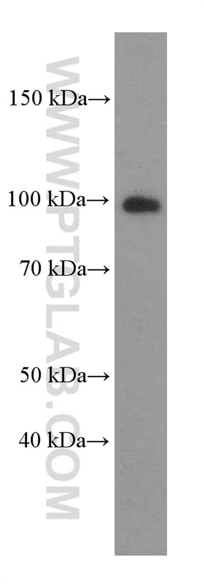 AKAP3 Antibody in Western Blot (WB)
