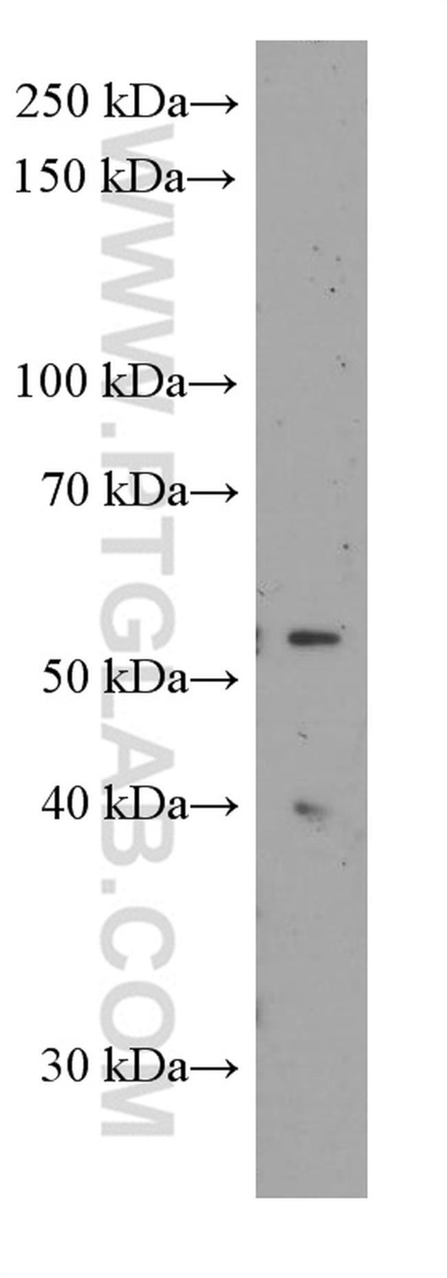 Sestrin2 Antibody in Western Blot (WB)