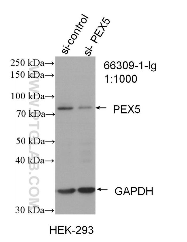 PEX5 Antibody in Western Blot (WB)