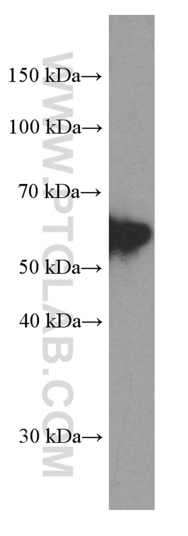 Peripherin Antibody in Western Blot (WB)