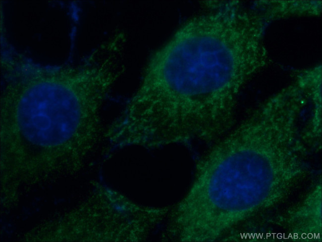 SFRP2 Antibody in Immunocytochemistry (ICC/IF)