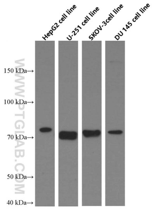 MMP2 Antibody in Western Blot (WB)