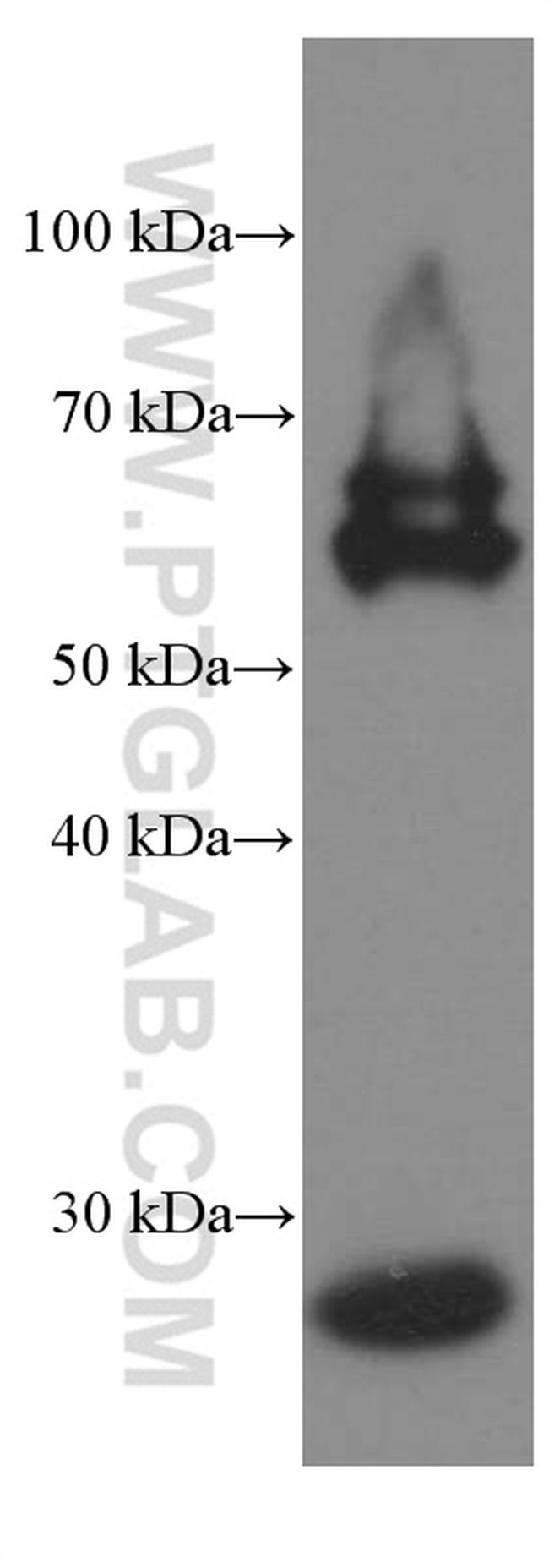 Calbindin-D28k Antibody in Western Blot (WB)