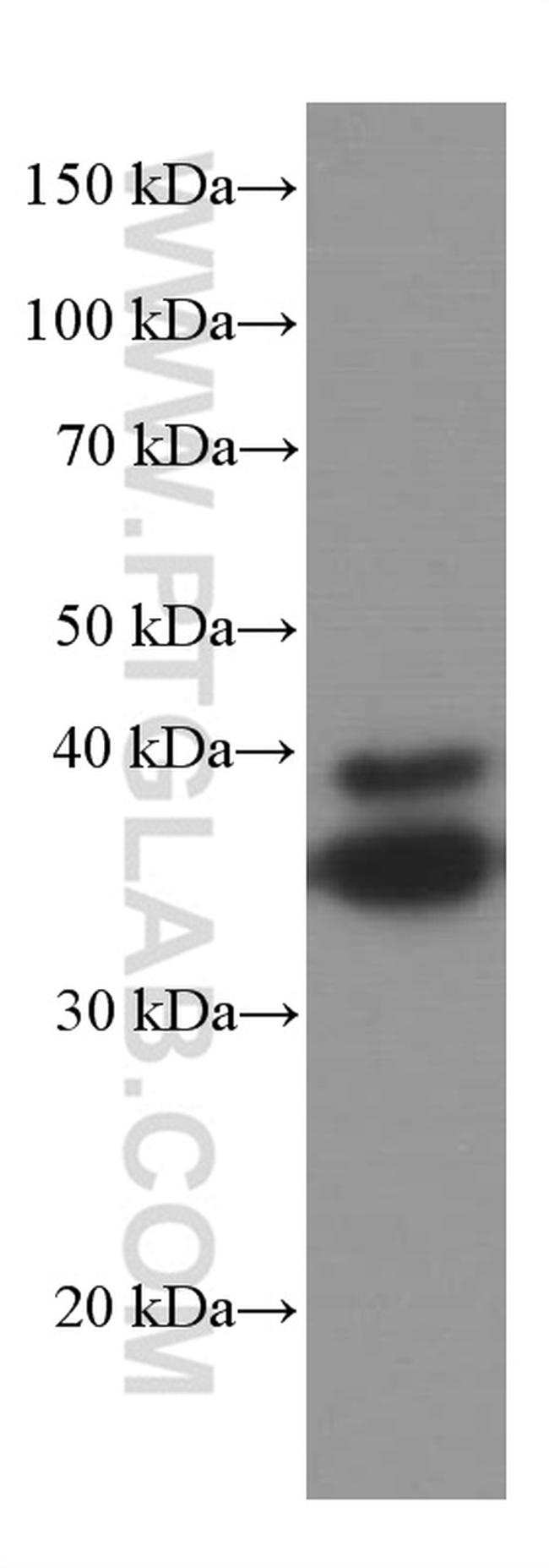 SIRT2 Antibody in Western Blot (WB)