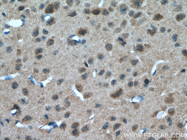 a-Synuclein Antibody in Immunohistochemistry (Paraffin) (IHC (P))