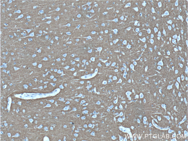 Syntaxin 1A / Syntaxin 1B Antibody in Immunohistochemistry (Paraffin) (IHC (P))