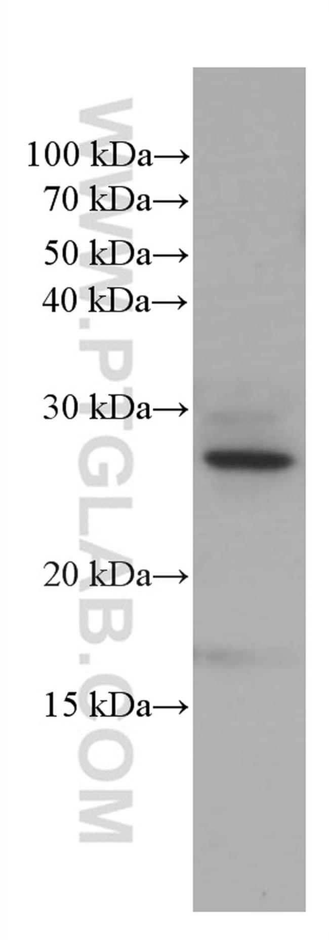 PEBP1 Antibody in Western Blot (WB)