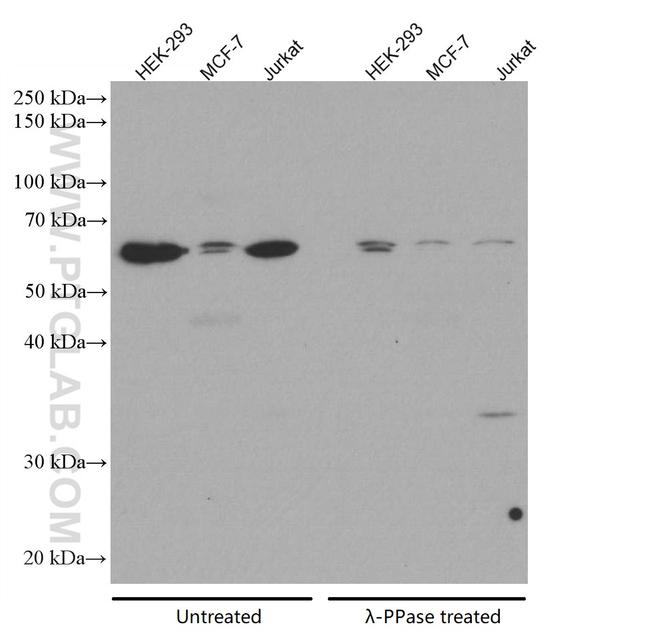 Phospho-AKT (Ser473) Antibody in Western Blot (WB)