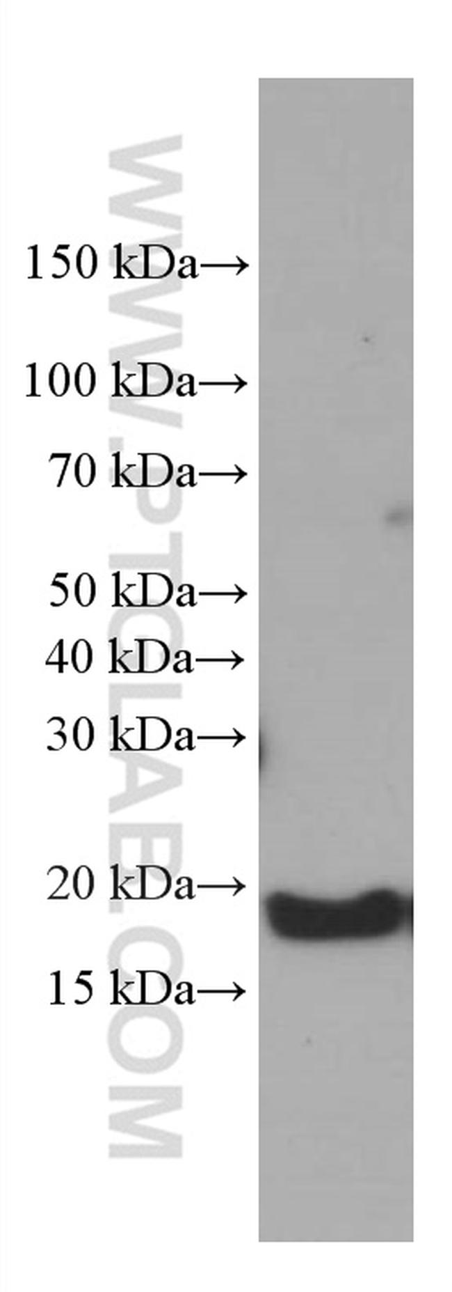 GABARAPL1 Antibody in Western Blot (WB)