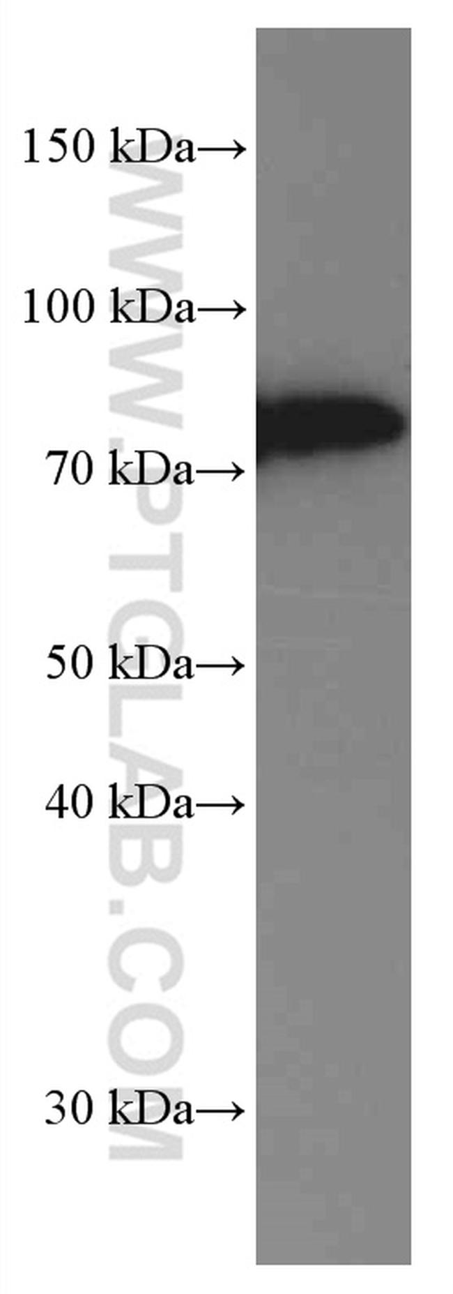 SLP76 Antibody in Western Blot (WB)
