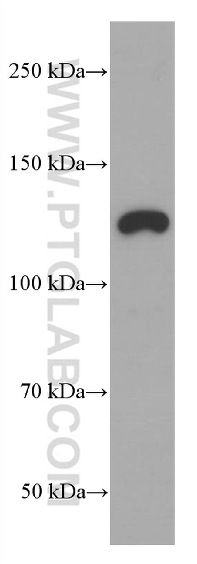 JAK1 Antibody in Western Blot (WB)