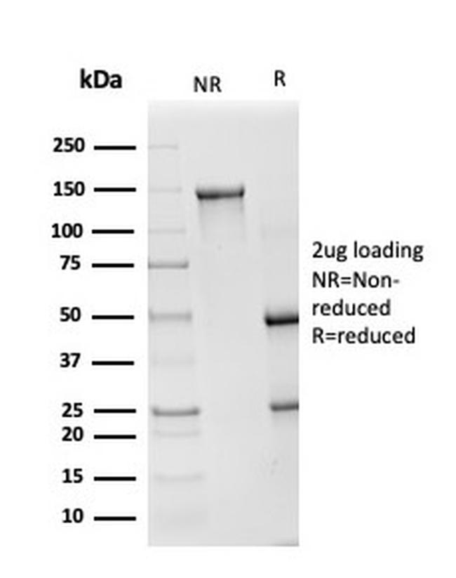 Superoxide Dismutase 1 (SOD1) (Antioxidant Enzyme) Antibody in SDS-PAGE (SDS-PAGE)