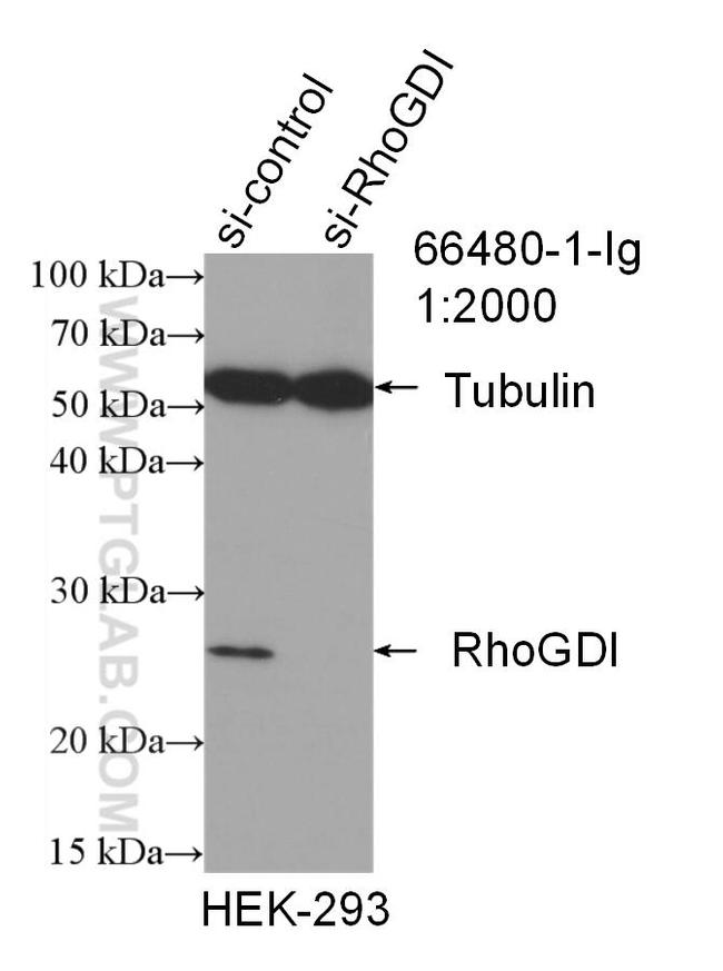 RhoGDI Antibody in Western Blot (WB)