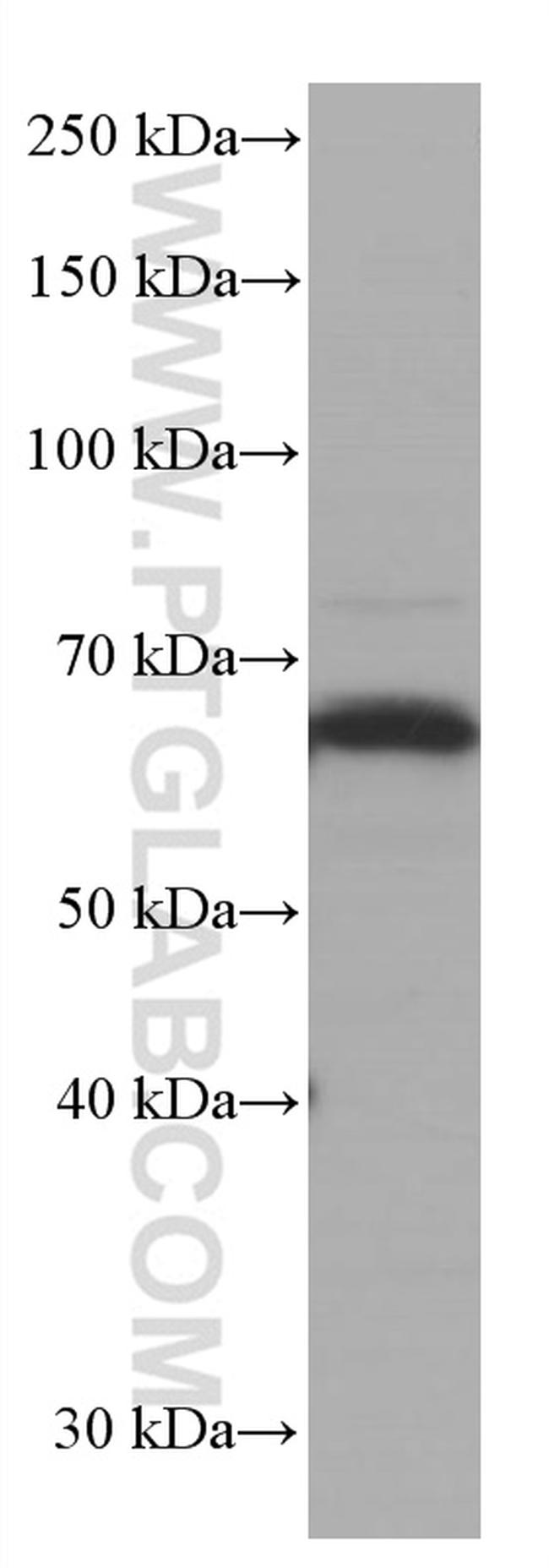 EIF2A Antibody in Western Blot (WB)