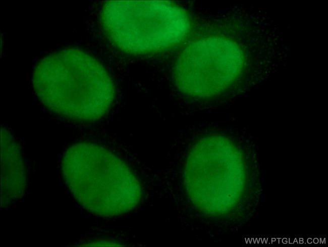 PARP1 Antibody in Immunocytochemistry (ICC/IF)