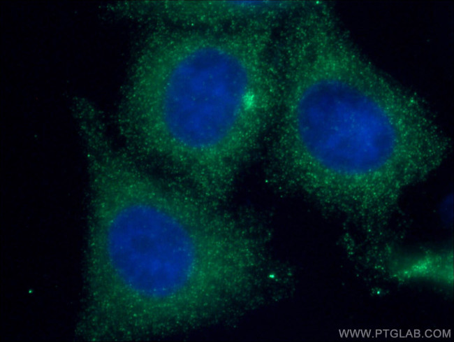 p65/RELA Antibody in Immunocytochemistry (ICC/IF)