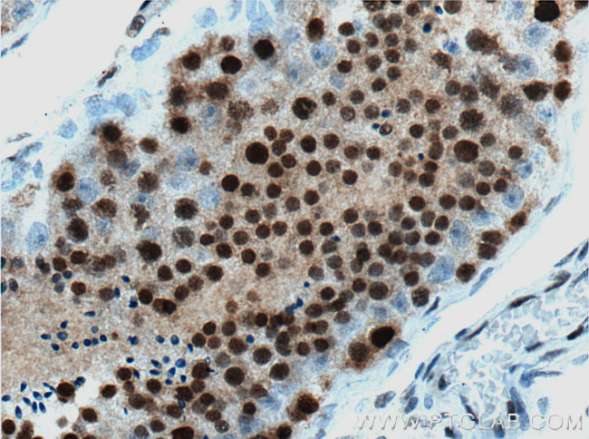 NHEJ1 Antibody in Immunohistochemistry (Paraffin) (IHC (P))