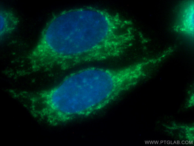 TOMM22 Antibody in Immunocytochemistry (ICC/IF)