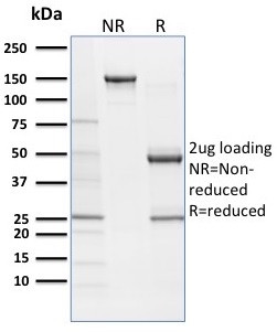 SOX9/SRY-box 9 Antibody in SDS-PAGE (SDS-PAGE)