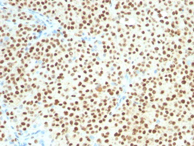 SOX10 (Melanoma Marker) Antibody in Immunohistochemistry (Paraffin) (IHC (P))