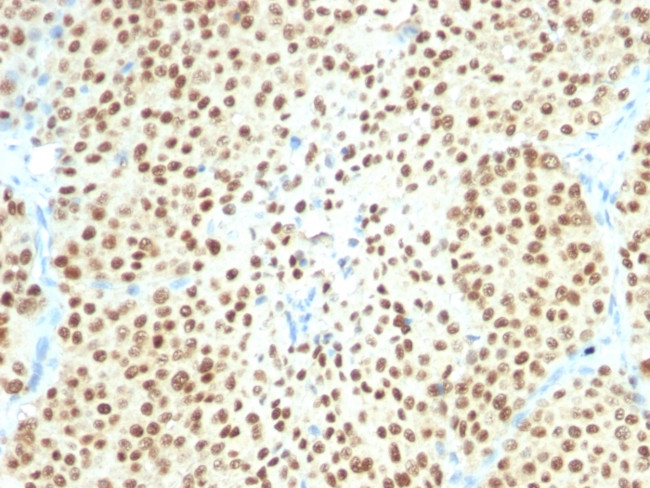SOX10 (Melanoma Marker) Antibody in Immunohistochemistry (Paraffin) (IHC (P))