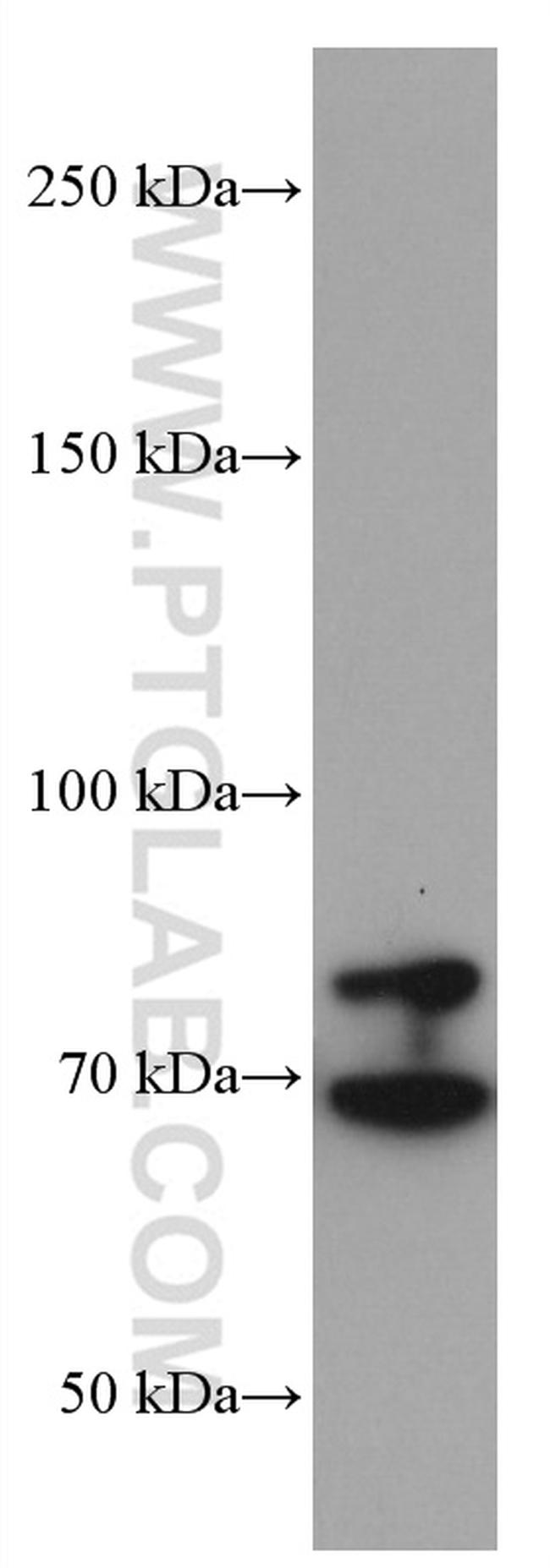 TGFBR2 Antibody in Western Blot (WB)