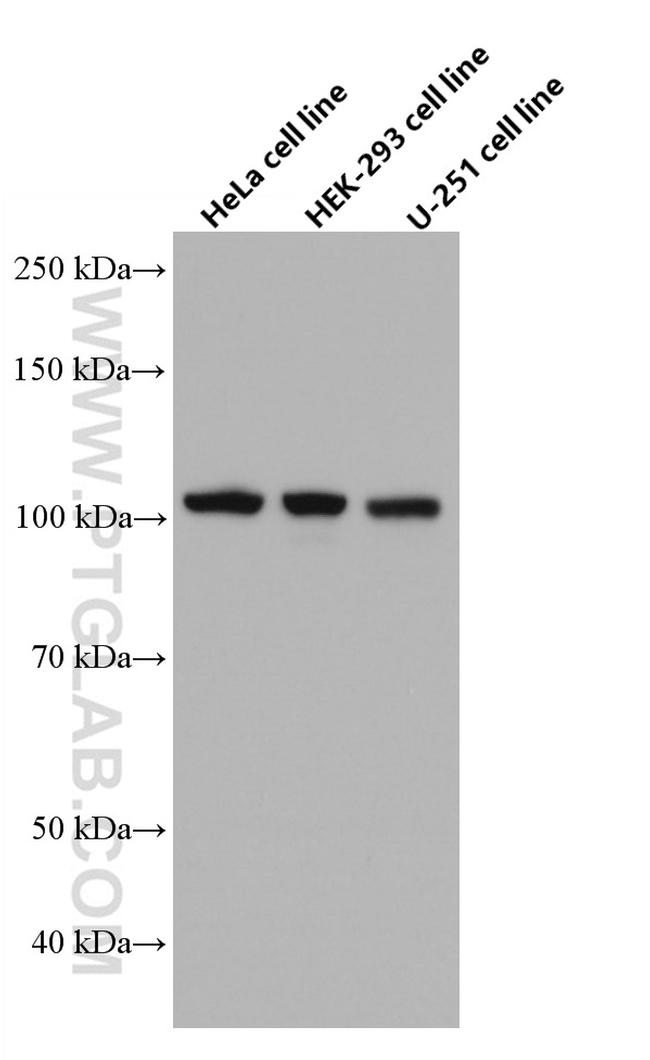 ANLN Antibody in Western Blot (WB)