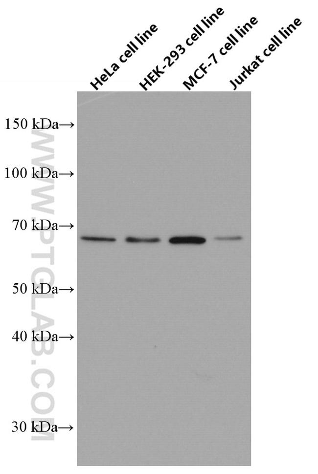 EIF2AK2 Antibody in Western Blot (WB)