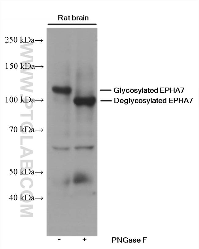 EPHA7 Antibody in Western Blot (WB)
